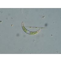 Closterium incurvum