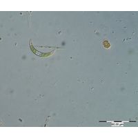 Closterium incurvum