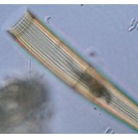 Closterium intermedium