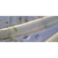 Closterium intermedium