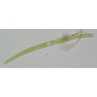 Closterium juncidum