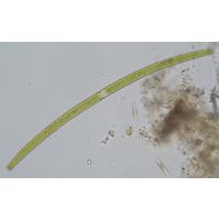 Closterium juncidum