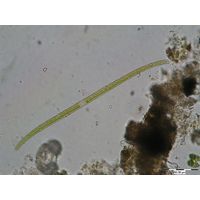 Closterium juncidum