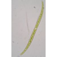 Closterium juncidum