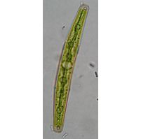 Closterium juncidum