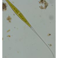 Closterium kuetzingii