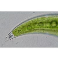 Closterium leibleinii