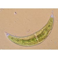 Closterium leibleinii
