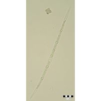 Closterium limneticum