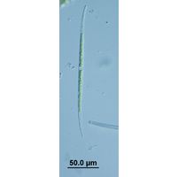 Closterium limneticum