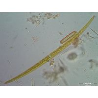 Closterium lineatum