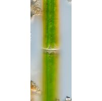Closterium lineatum var. elongatum