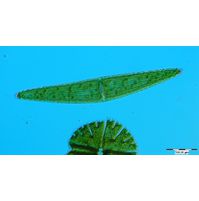 Closterium lunula