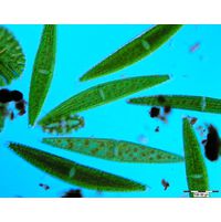 Closterium lunula