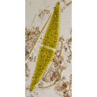 Closterium lunula