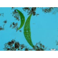Closterium moniliferum