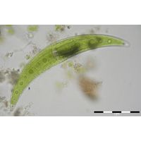 Closterium moniliforme