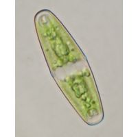 Closterium navicula