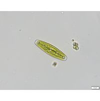 Closterium navicula