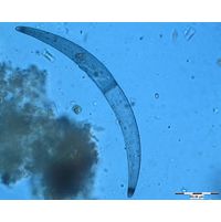 Closterium nematodes