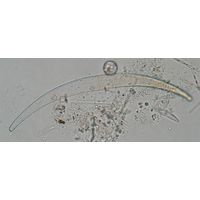 Closterium nematodes