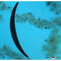 Closterium nematodes