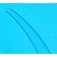 Closterium nematodes