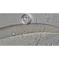 Closterium nematodes