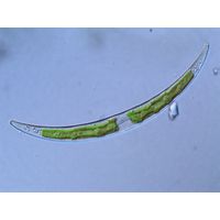 Closterium parvulum