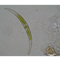 Closterium parvulum