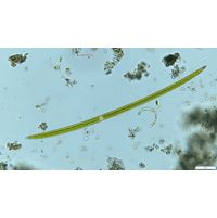 Closterium praelongum