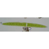 Closterium pritchardianum