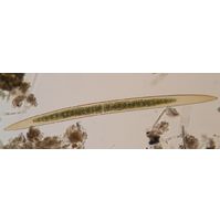 Closterium pritchardianum