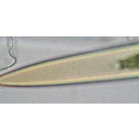 Closterium pritchardianum