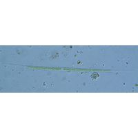 Closterium pronum