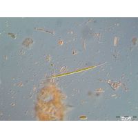 Closterium pronum