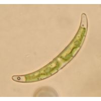 Closterium pseudopygmaeum