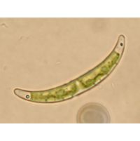 Closterium pseudopygmaeum