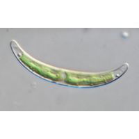 Closterium pseudopygmaeum