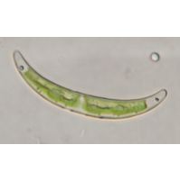 Closterium pseudopygmaeum
