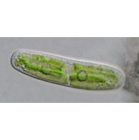 Closterium pusillum