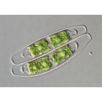 Closterium pusillum