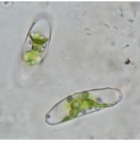 Closterium