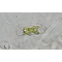 Closterium