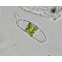 Closterium