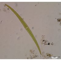 Closterium ralfsii