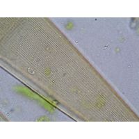 Closterium ralfsii