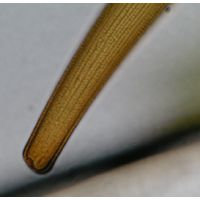 Closterium ralfsii