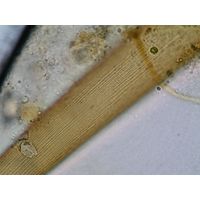 Closterium ralfsii