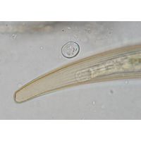 Closterium